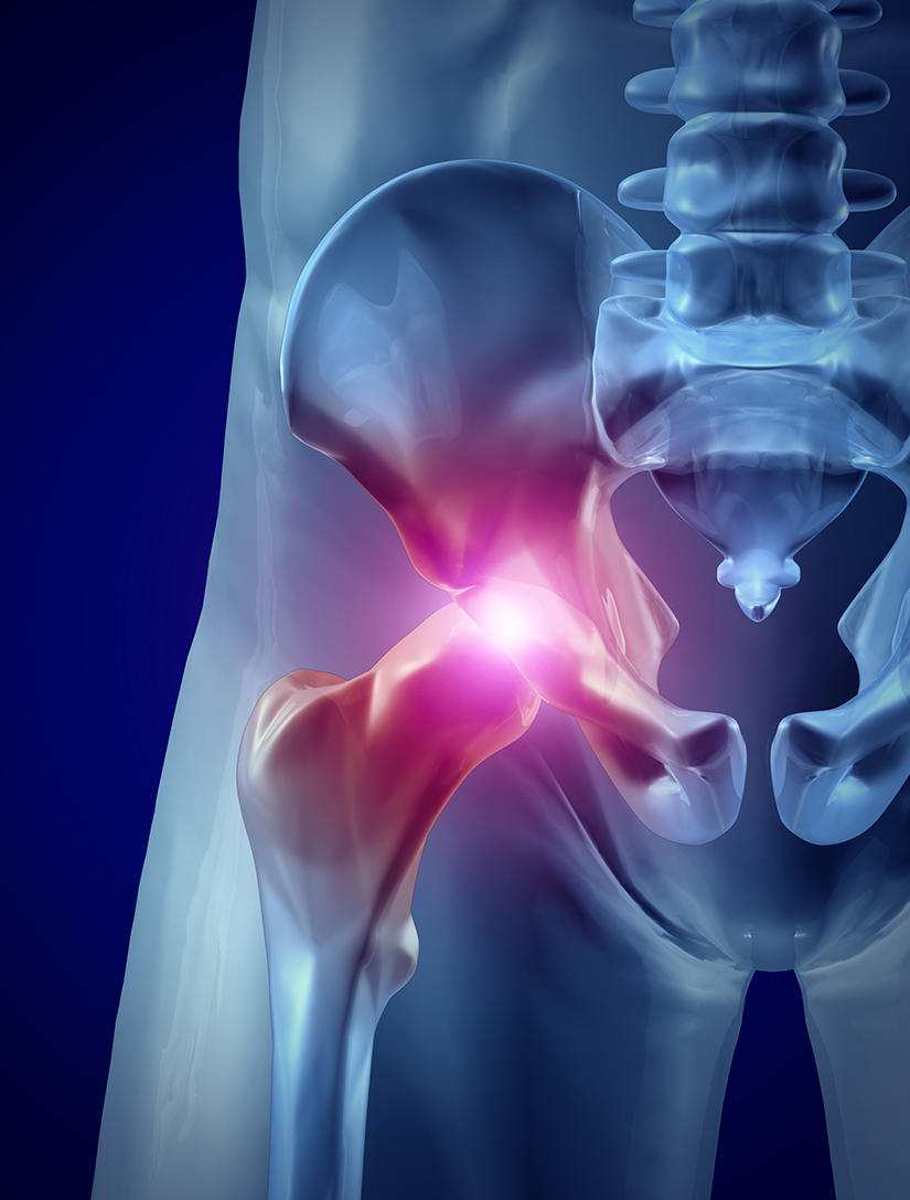 Hip joint inflamed