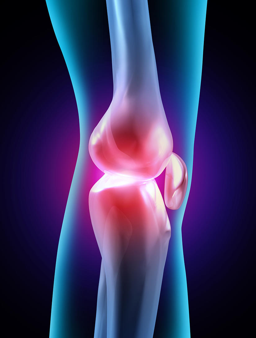 knee joint inflammed